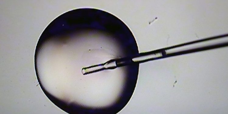 Republicans, pro-life advocates split on Trump’s proposal to federally subsidize IVF